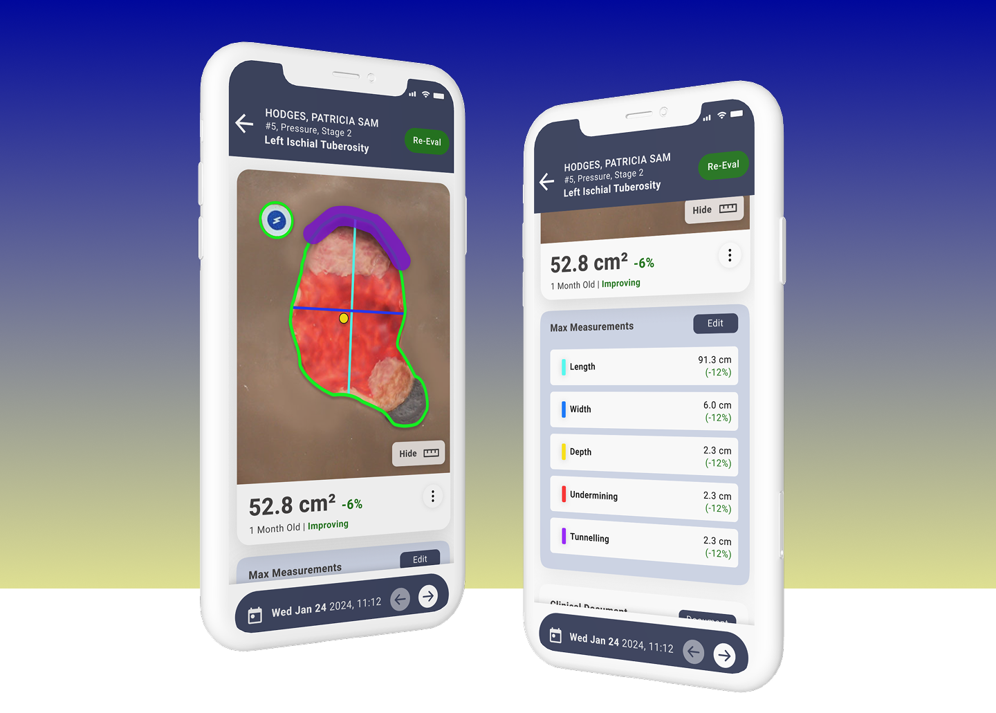 Two Swift wound assessment mobile screens on a blue and green gradient background
