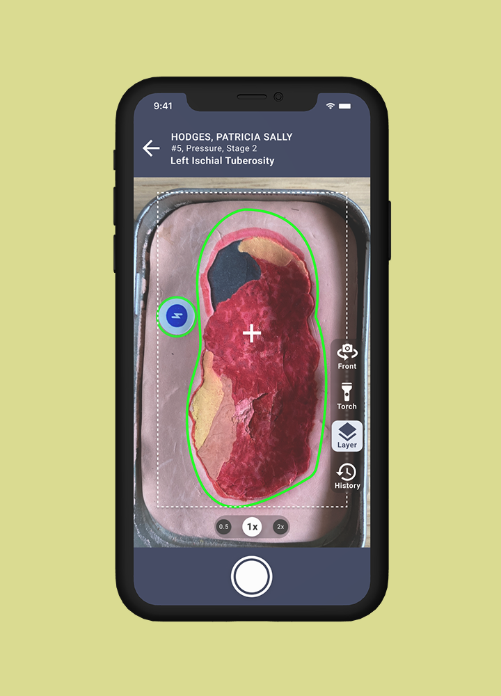 Swift wound camera workflow on an iPhone