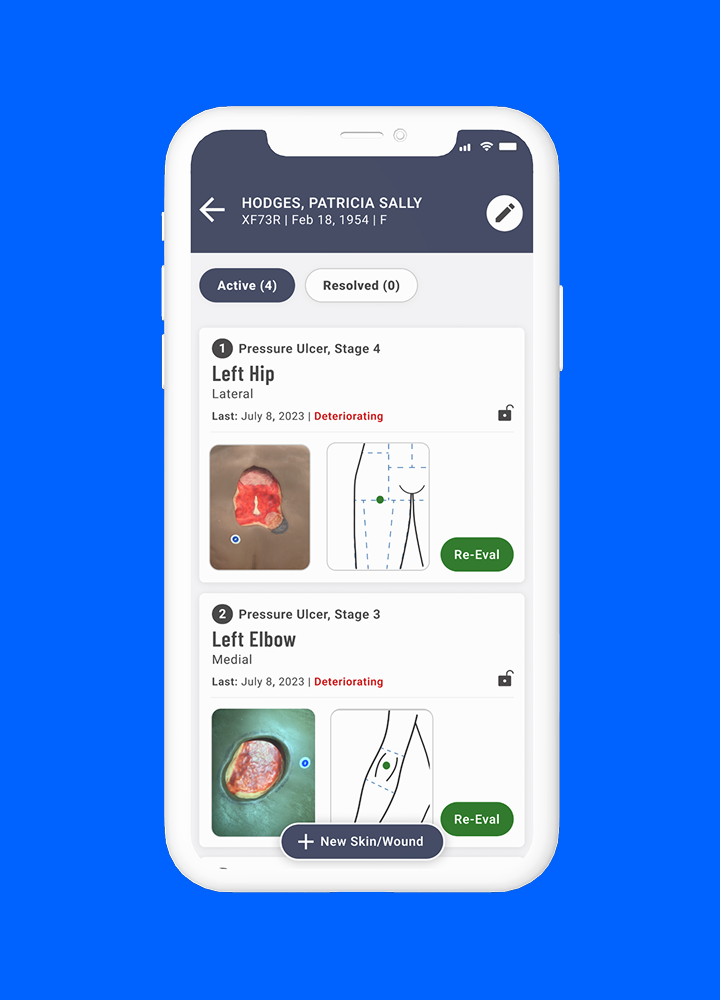 Swift wound list workflow on an iPhone
